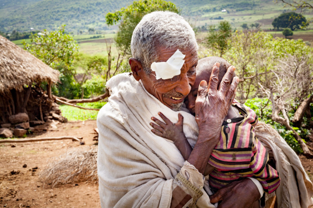 Elderly Man with eye patch hugging small child